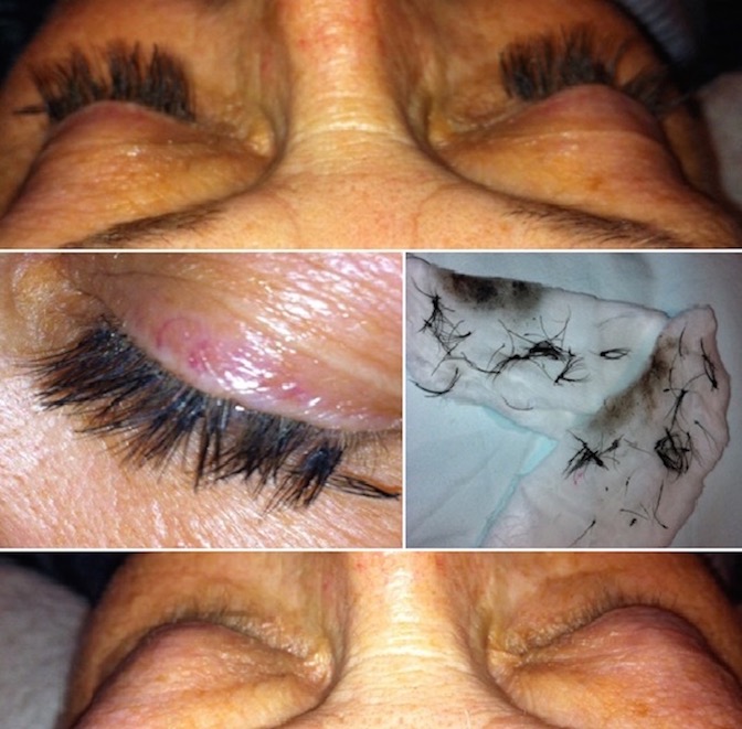 Before and After Eyelash Extensions 12